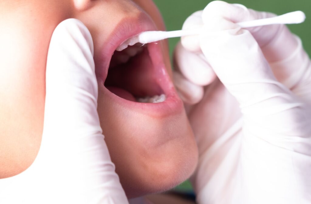 A dentist applying fluoride varnish to a patient.